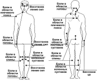 Точки акупунктури в голкотерапії